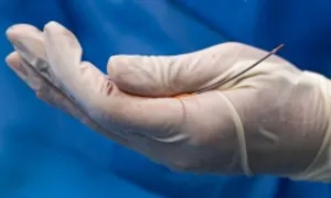 Các loại stent điều trị hẹp mạch vành, nhồi máu cơ tim