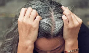 Ba cách đảo ngược tóc bạc không cần nhuộm Ba cách đảo ngược tóc bạc không cần nhuộm