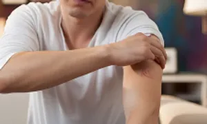 4 thay đổi trên da cảnh báo bệnh gan 4 thay đổi trên da cảnh báo bệnh gan