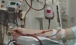 Có nên lọc máu phòng mỡ máu cao? Có nên lọc máu phòng mỡ máu cao?