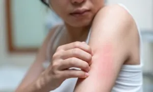 Nên tiêm vaccine gì khi thường xuyên bị muỗi đốt? Nên tiêm vaccine gì khi thường xuyên bị muỗi đốt?